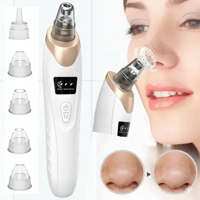 DermaVac Pro 5-in-1 USB Rechargeable Blackhead Remover Vacuum - Deep Pore & Acne Cleaner