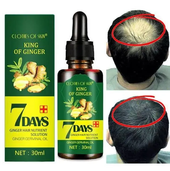 7 Day Hair Growth Serum – 30ML Herbal Hair Care & Nutrition Liquid for Stronger, Thicker Hair